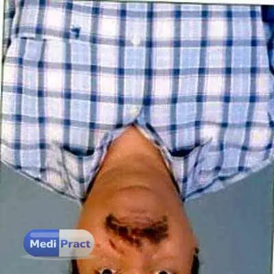 Dr. Dinesh Mohan Profile Picture